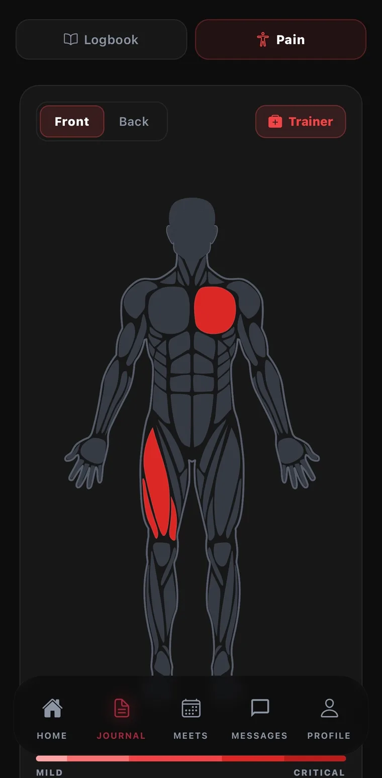 L'onglet douleur dans l'application Atra : une carte du corps pour situer la douleur, avec l'historique des blessures de l'athlète en dessous.